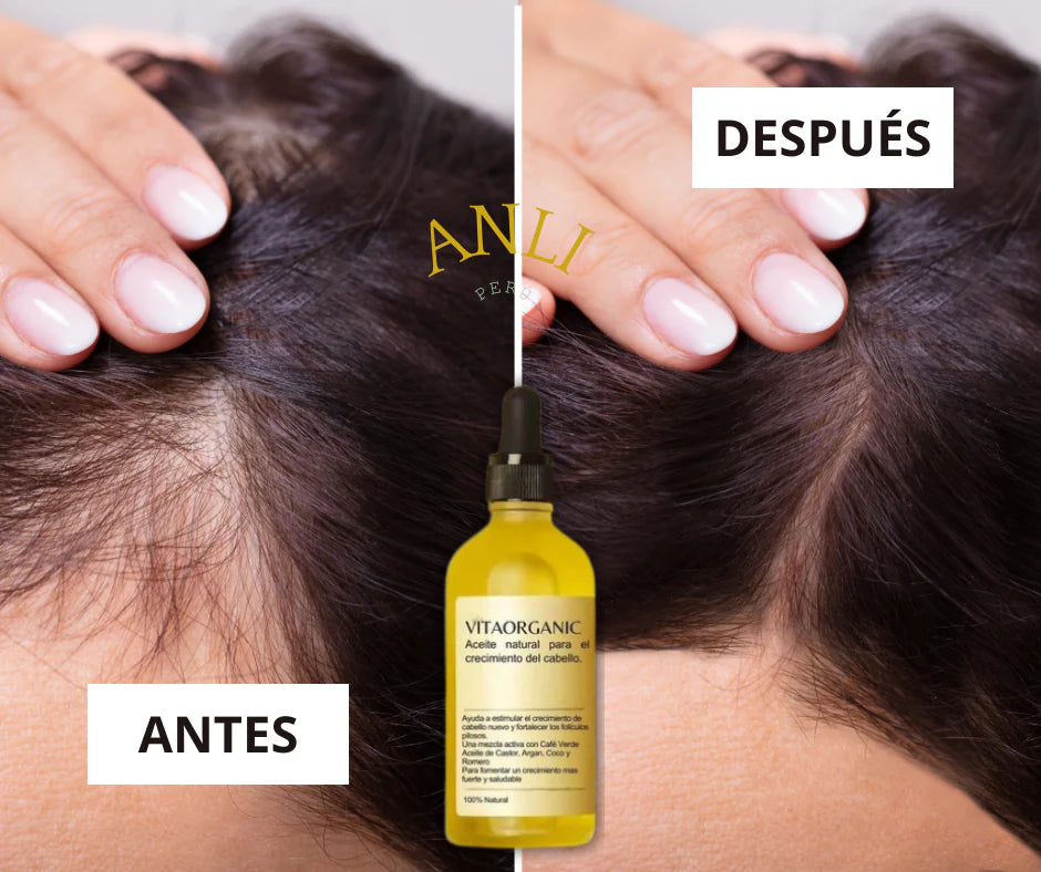 Tónico Capilar de Aceite para Crecimiento de Cabello